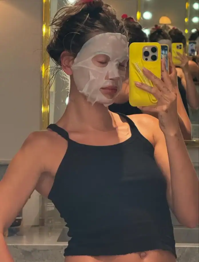 Hailey Bieber “Perioral Dermatit” Deneyimini Paylaştı