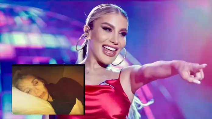 İrem Derici Talihsiz Kaza Geçirdi Başına 10 Dikiş Atıldı