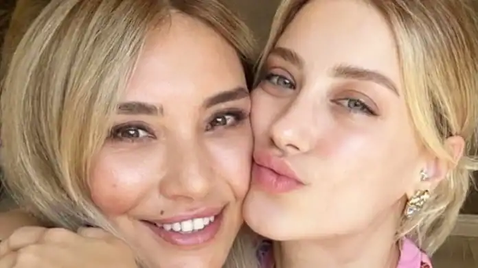 Hazal Kaya’nın Yüzündeki Değişim Estetik İddialarını Alevlendirdi