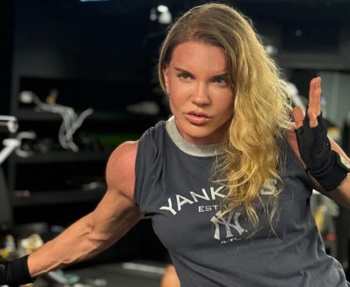 Biricik Suden'in Dermapen Sonrası Görüntüsü Gündem Oldu