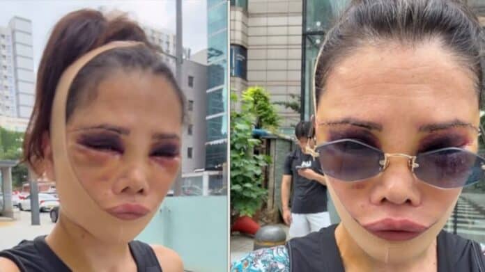 Didem Ceran Yeniden Ameliyat Oldu ve Gelen Eleştirilere Cevap Verdi