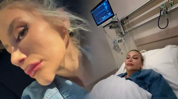 İrem Derici'nin Çenesindeki Şişliğin Nedeni Belli Oldu