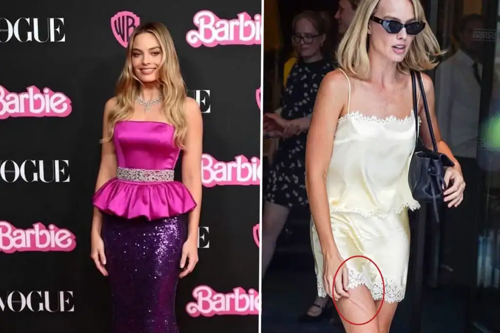 Margot Robbie'nin Bacağındaki Morluk Sosyal Medyada Gündem Oldu
