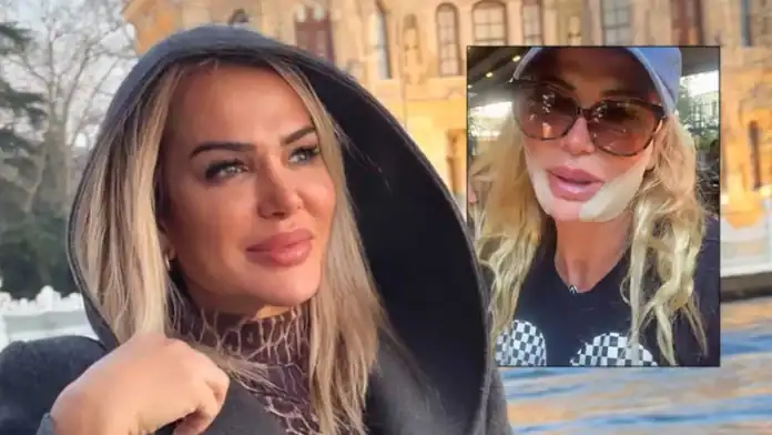 Nagihan Karadere'den Survivor Sonrası Estetik Operasyon