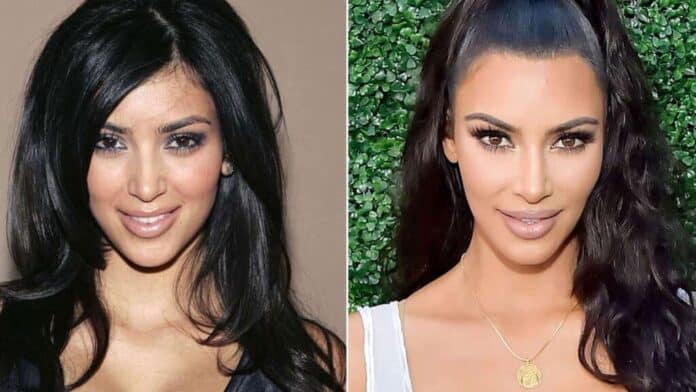 Kim Kardashian'ın Yaşlandırma Filtresi Tepkisi